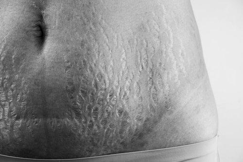 Let's Love on our Postpartum Bodies | Mum Bub Hub