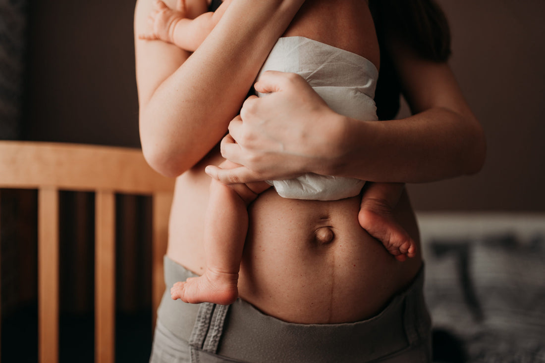 How to use Witch Hazel for Postpartum Healing