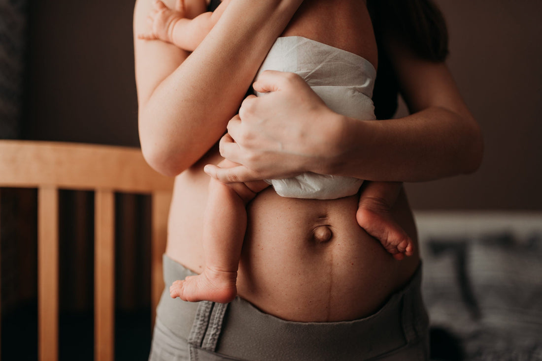 How to use Witch Hazel for Postpartum Healing